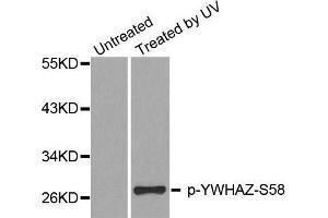 Image no. 1 for anti-14-3-3 zeta (YWHAZ) (pSer58) antibody (ABIN3019773)