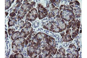 Image no. 4 for anti-Tumor Protein D52-Like 3 (TPD52L3) antibody (ABIN1501475)