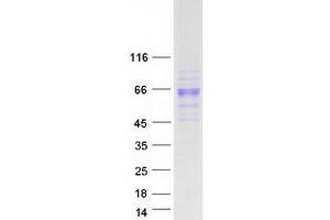 Image no. 1 for Pregnancy Specific beta-1-Glycoprotein 1 (PSG1) protein (Myc-DYKDDDDK Tag) (ABIN2713764)
