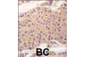 Image no. 2 for anti-Transforming Growth Factor, beta 2 (TGFB2) (AA 277-306), (C-Term) antibody (ABIN5536427)