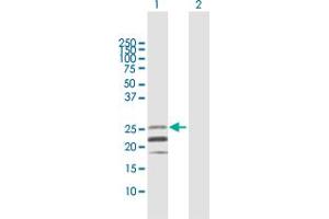 Western Blot analysis of CD70 expression in transfected 293T cell line by CD70 MaxPab polyclonal antibody.