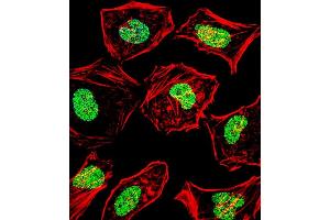 Fluorescent confocal image of Hela cell stained with HAND2 Antibody (Center) (ABIN1538642 and ABIN2848660).