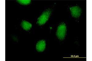 Image no. 4 for anti-Regulatory Solute Carrier Protein, Family 1, Member 1 (RSC1A1) (AA 1-617) antibody (ABIN519924)