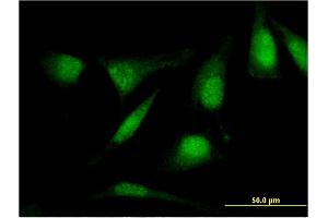 Immunofluorescence of monoclonal antibody to RASSF4 on HeLa cell.