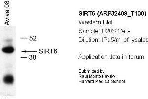 anti-Sirtuin 6 (SIRT6) (Middle Region) antibody