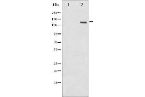 Image no. 2 for anti-PTK2 Protein tyrosine Kinase 2 (PTK2) (pTyr861) antibody (ABIN6256813)