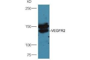 Image no. 1 for anti-VEGF Receptor 2 (VEGFR2) (AA 101-200) antibody (ABIN2180045)