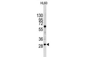 Image no. 1 for anti-Lin-28 Homolog B (LIN28B) (N-Term) antibody (ABIN357011)