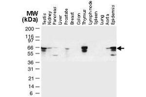 Image no. 1 for anti-TNF Receptor-Associated Factor 6 (TRAF6) antibody (ABIN537432)