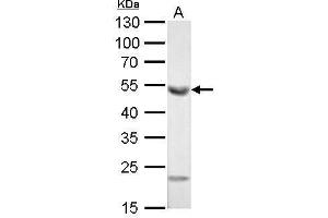 Image no. 1 for anti-Aldehyde Dehydrogenase 1 Family, Member A1 (ALDH1A1) (C-Term) antibody (ABIN2857033)