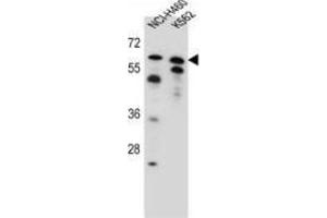 Western blot analysis in NCI-H460, K562 cell line lysates (35ug/lane) using PLAG1  Antibody (N-term).