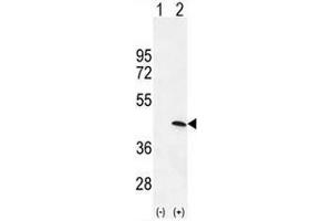 Image no. 1 for anti-Protein Kinase, AMP-Activated, gamma 1 Non-Catalytic Subunit (PRKAG1) (AA 5-33), (N-Term) antibody (ABIN950401)