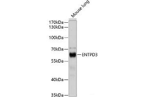Western blot analysis of extracts of Mouse lung using ENTPD3 Polyclonal Antibody at dilution of 1:1000.