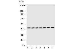 Image no. 5 for anti-Enoyl-CoA Delta Isomerase 1 (ECI1) (C-Term) antibody (ABIN3030698)
