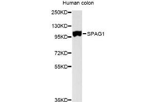 Image no. 1 for anti-Sperm Associated Antigen 1 (SPAG1) antibody (ABIN1874916)