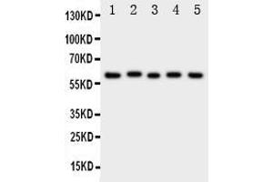 Image no. 1 for anti-Amiloride-Sensitive Cation Channel 3 (ACCN3) (AA 56-73), (N-Term) antibody (ABIN3042990)