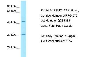 Image no. 1 for anti-Succinate-CoA Ligase, ADP-Forming, beta Subunit (SUCLA2) (N-Term) antibody (ABIN2789920)
