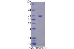 Image no. 1 for C-terminal Binding Protein 2 (CTBP2) (AA 1-252) protein (His tag) (ABIN6237097)