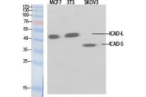 Image no. 2 for anti-DNA Fragmentation Factor, 45kDa, alpha Polypeptide (DFFA) (Internal Region) antibody (ABIN3185120)