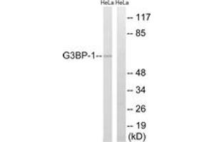 Image no. 1 for anti-GTPase Activating Protein (SH3 Domain) Binding Protein 1 (G3BP1) (AA 199-248) antibody (ABIN1532878)