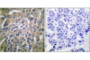 Image no. 2 for anti-HCG beta (AA 101-150) antibody (ABIN1533301)