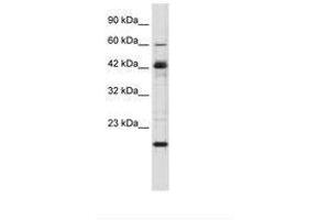 Image no. 2 for anti-Zinc Finger Protein 24 (ZNF24) (AA 189-238) antibody (ABIN6735862)