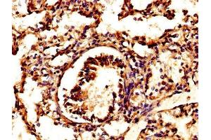 IHC image of ABIN7164840 diluted at 1:500 and staining in paraffin-embedded human lung tissue performed on a Leica BondTM system.