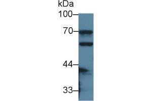 Image no. 2 for anti-Carboxylesterase 1 (CES1) (AA 31-286) antibody (ABIN5013292)