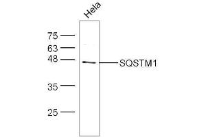 Image no. 4 for anti-Sequestosome 1 (SQSTM1) (AA 51-150) antibody (ABIN682153)