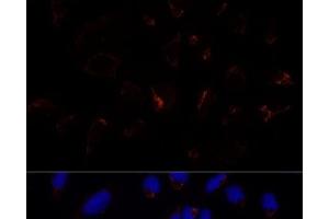 Immunofluorescence analysis of U-2 OS cells using ETHE1 Polyclonal Antibody at dilution of 1:100 (40x lens).