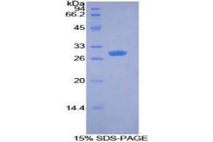 Image no. 1 for Pyruvate Dehydrogenase Kinase 1 (PDK1) (AA 172-399) protein (His tag) (ABIN1878476)