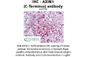 Image no. 1 for anti-Axin 1 (AXIN1) (C-Term) antibody (ABIN1732156)