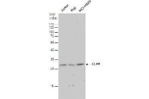 Image no. 2 for anti-ClpP Caseinolytic Peptidase, ATP-Dependent, Proteolytic Subunit Homolog (E. Coli) (CLPP) (C-Term) antibody (ABIN2855887)