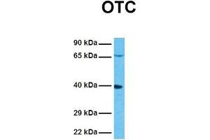 Image no. 4 for anti-Ornithine Carbamoyltransferase (OTC) (N-Term) antibody (ABIN2773791)