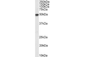 Image no. 1 for anti-Interferon Regulatory Factor 4 (IRF4) (C-Term) antibody (ABIN940553)