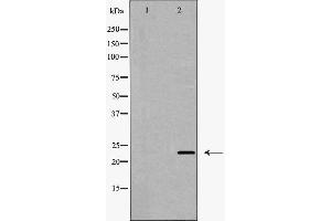 Image no. 4 for anti-Claudin 5 (CLDN5) antibody (ABIN6260869)