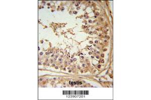 Image no. 2 for anti-F-Box and Leucine-Rich Repeat Protein 5 (FBXL5) (AA 86-115), (N-Term) antibody (ABIN653358)
