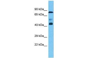 Image no. 1 for anti-Zinc Finger Protein 362 (ZNF362) (N-Term) antibody (ABIN2784335)