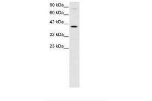 Image no. 3 for anti-KIN, Antigenic Determinant of RecA Protein Homolog (KIN) (AA 230-279) antibody (ABIN6735789)