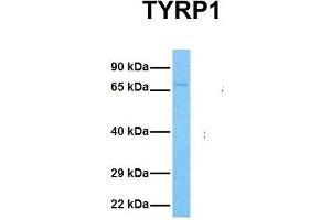 Image no. 3 for anti-Tyrosinase-Related Protein 1 (TYRP1) (Middle Region) antibody (ABIN2781815)
