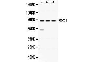 Image no. 1 for anti-ATP-Binding Cassette, Sub-Family E (OABP), Member 1 (ABCE1) (AA 419-599) antibody (ABIN4886410)
