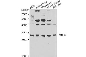 Image no. 1 for anti-Mitochondrial Translational Initiation Factor 3 (MTIF3) antibody (ABIN6567592)