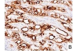Image no. 15 for anti-L1 Cell Adhesion Molecule (L1CAM) (AA 1-1120) antibody (ABIN1995799)