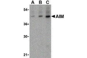 Image no. 1 for anti-CD5 Molecule-Like (CD5L) (N-Term) antibody (ABIN2472166)