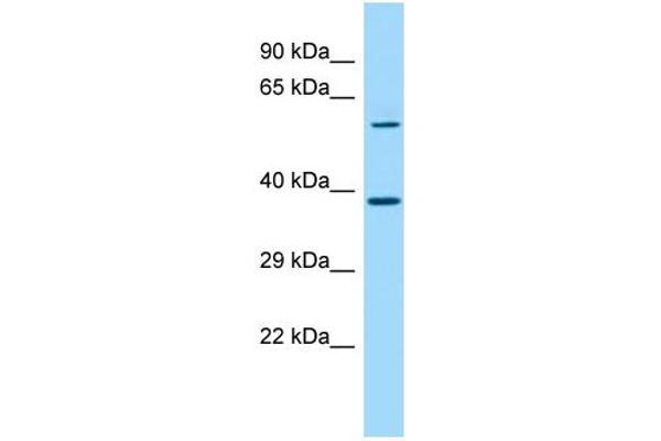 SDAD1 antibody  (C-Term)