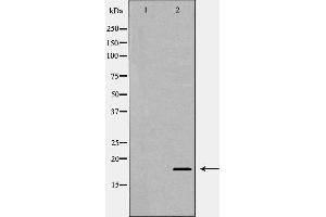 Image no. 2 for anti-MYC Associated Factor X (MAX) (N-Term) antibody (ABIN6263144)