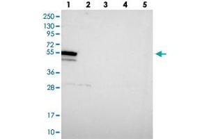 Image no. 1 for anti-DEAH (Asp-Glu-Ala-His) Box Polypeptide 34 (DHX34) antibody (ABIN5576588)