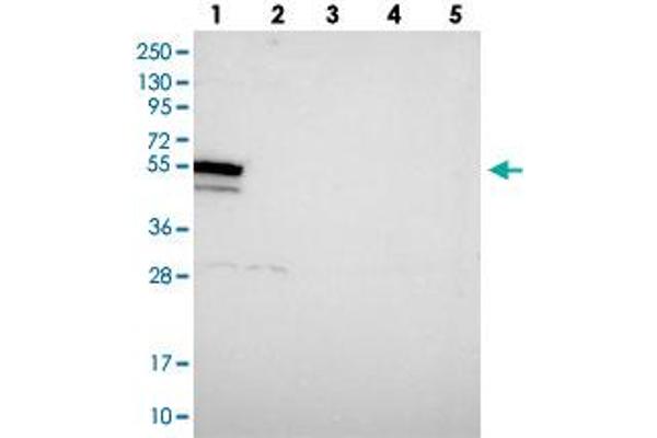 anti-DEAH (Asp-Glu-Ala-His) Box Polypeptide 34 (DHX34) antibody