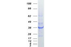 Image no. 1 for Secreted Protein, Acidic, Cysteine-Rich (Osteonectin) (SPARC) protein (Myc-DYKDDDDK Tag) (ABIN2732503)