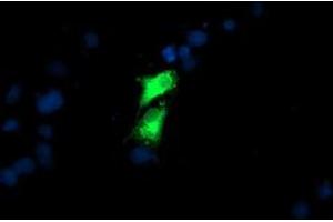 Image no. 9 for anti-Golgi Membrane Protein 1 (GOLM1) antibody (ABIN1498491)